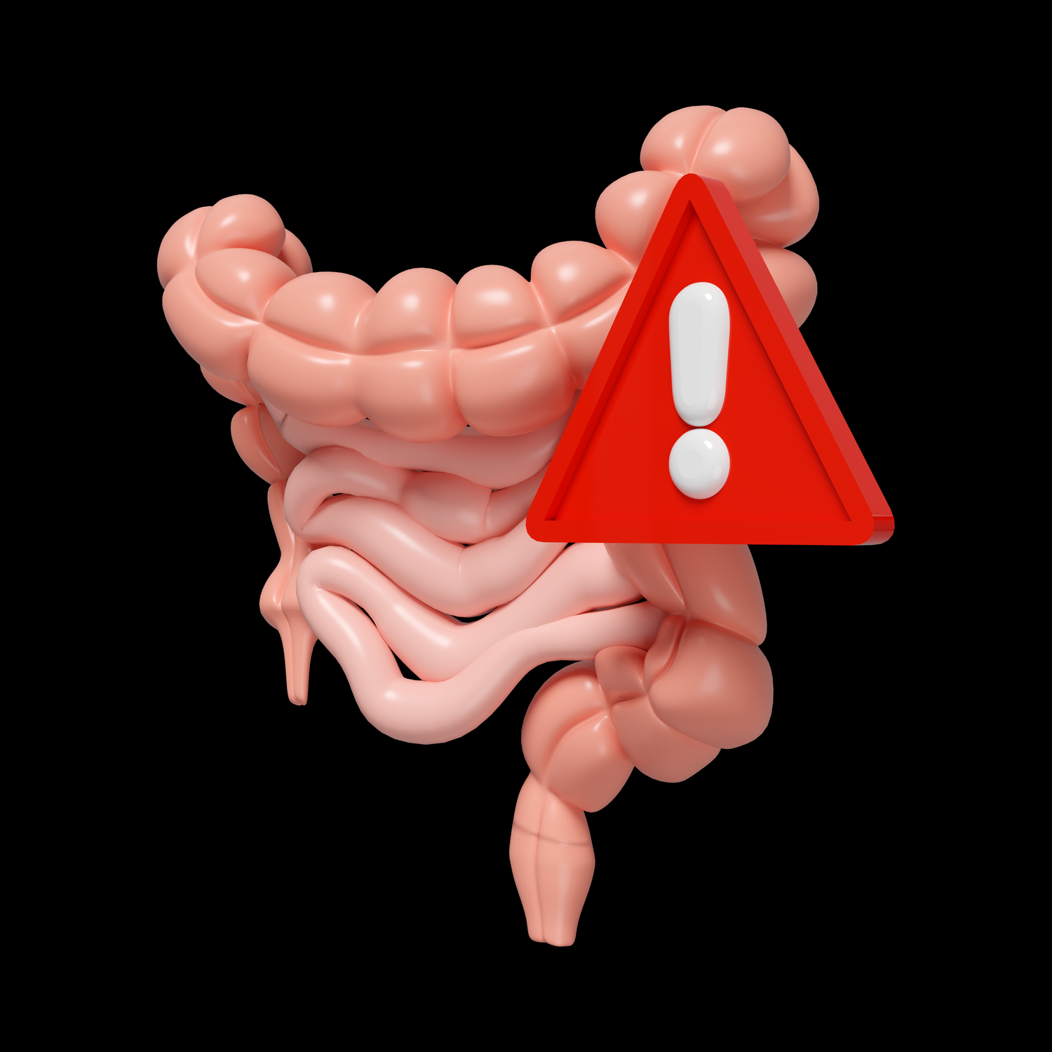 Colon irritable